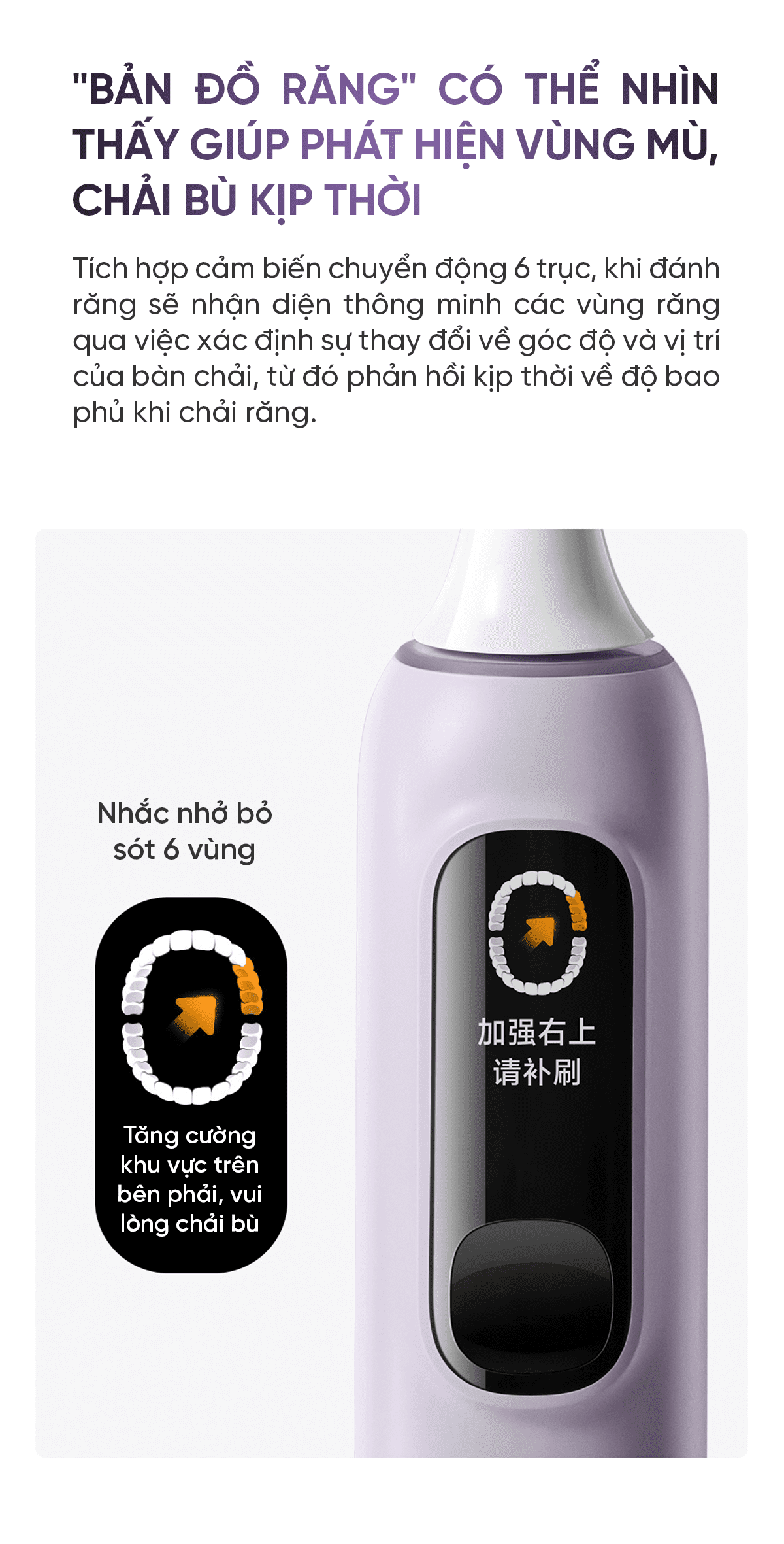 Bàn chải điện Xiaomi Mijia sonic sweep pro MES610